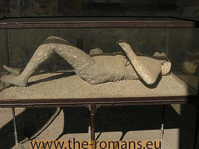 Plaster cast 