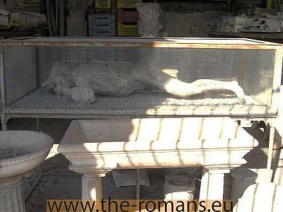 Plaster cast 